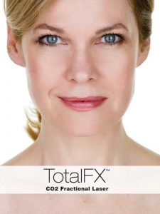 Total FX - CO2 Fractional Laser