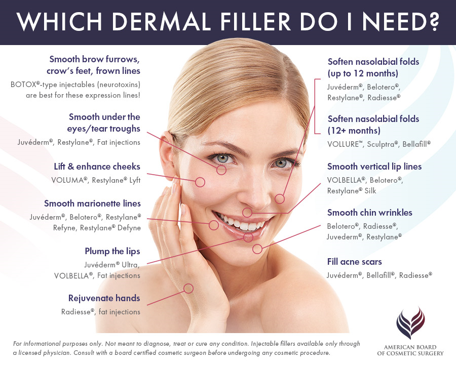 Which Derma Fillers Do I Need?