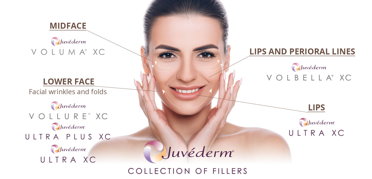 Juvederm Collection of Fillers